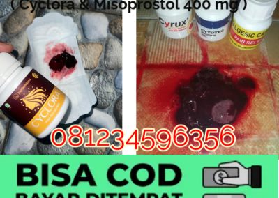 Mengenal Obat Miso Fungsi Asli dan Fakta Sebagai Obat Penggugur Kandungan