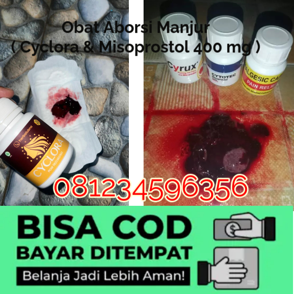 Obat Aborsi Asli Cytotec Misoprostol Sebagai Obat Penggugur Kandungan