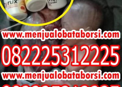 Jual Obat Penggugur Kandungan Cytotec dan Gastrul di Jakarta 082225312225 Harga Obat Cytotec 400 mcg K24 / Kimia Farma