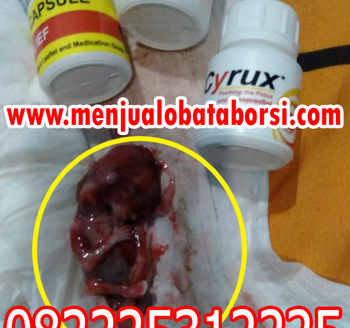 Pilihan 7 Obat Aborsi Paling Aman Menurut Rekomendasi Medis