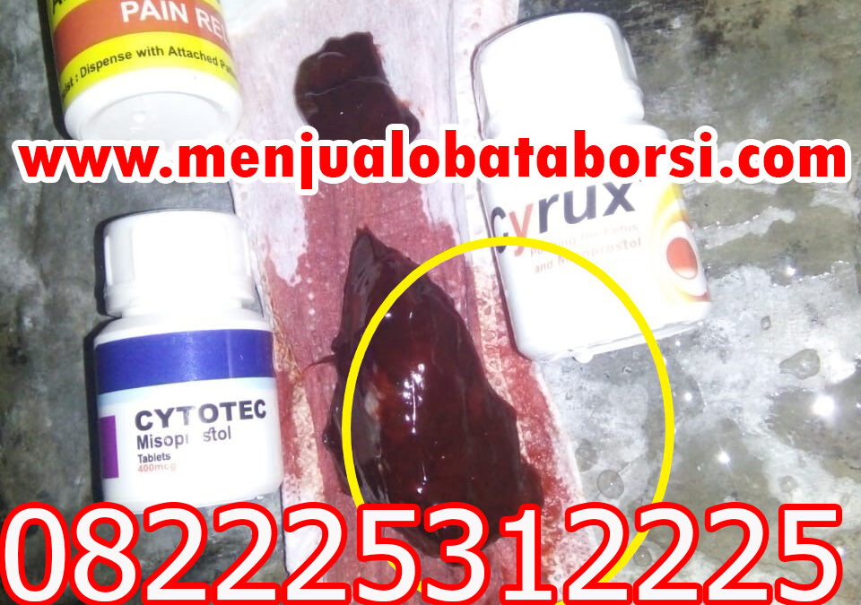 Bedanya Obat Aborsi Cytote Misoprostol dan Gastrul yang perlu kamu tahu