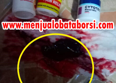 Obat Pelancar Haid di Apotik Jakarta 082225312225 Harga Obat Cytotec 400 mcg K24 / Kimia Farma