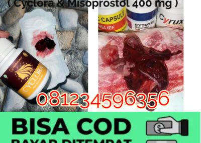 Materi Edukasi Obat Cytotec Misoprostol Penggunaan Efek Samping dan Risiko