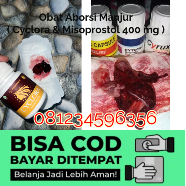 5 Cara Menggugurkan Kandungan Cepat Selesai Dalam 24 Jam Secara Alami