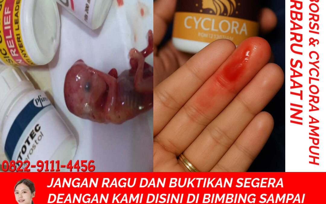 Apotik K24 Jual Obat Aborsi Asli 082291114456 Jual Cytotec Aceh Besar