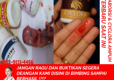 Apotik K24 Jual Obat Aborsi Asli 082291114456 Jual Cytotec Aceh Besar