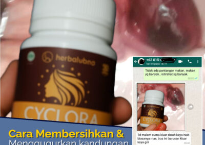Cara mempercepat menstruasi Cyclora: Atasi Penyebab Telat Haid dan Solusinya