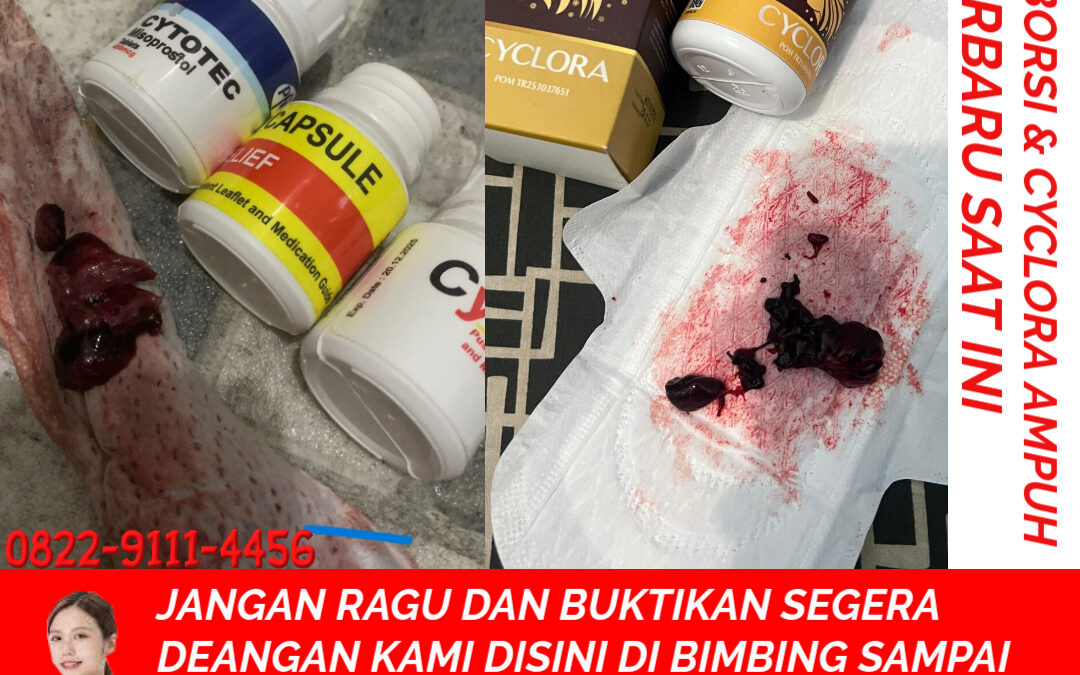 Obat Cytotec 400 mg: Fungsi Obat Aborsi, Obat Penggugur Kandungan, dan Efek Samping