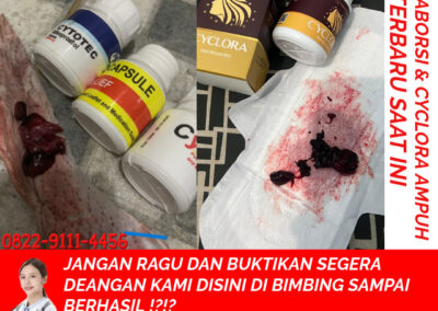 Obat Cytotec 400 mg: Fungsi Obat Aborsi, Obat Penggugur Kandungan, dan Efek Samping