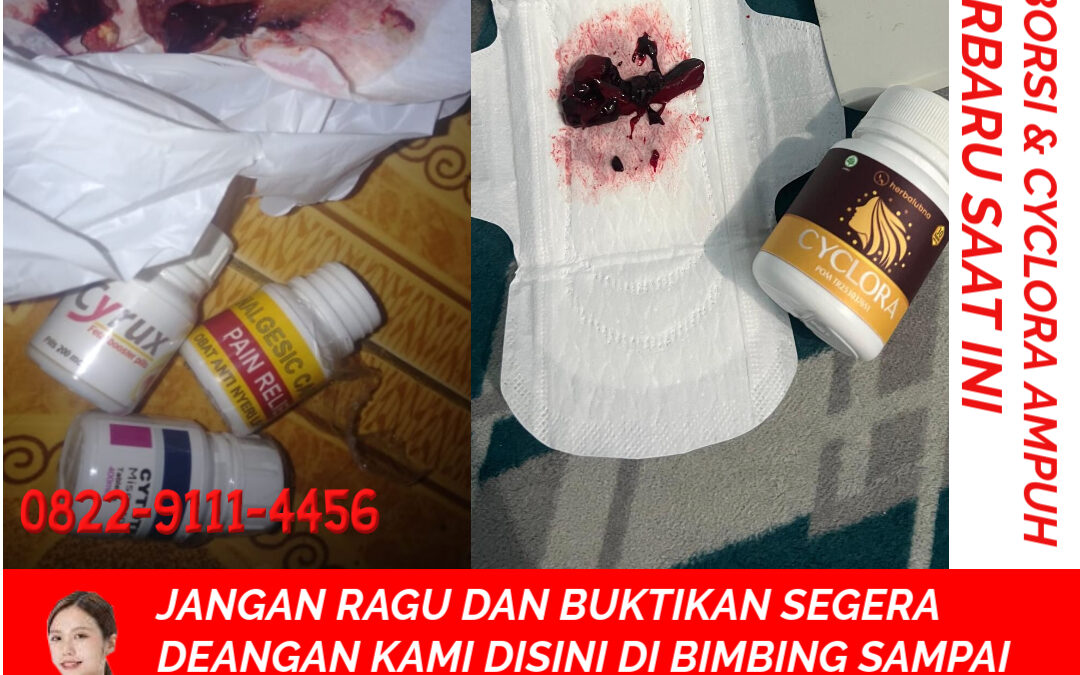 Apotik K24 Jual Obat Aborsi Asli 082291114456 Jual Cytotec Aceh Barat Daya
