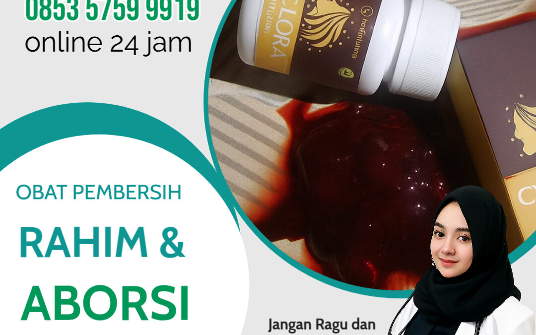 Penyebab Telat Haid dan Solusinya Menggunakan Obat Cyclora