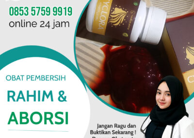 Obat telat datang bulan di apotik Cyclora: Atasi Penyebab Telat Haid dan Solusinya