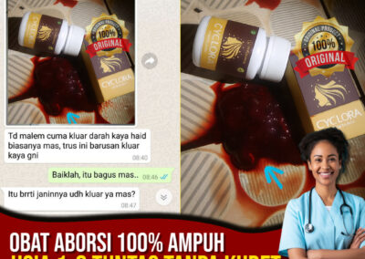 Pilihan Terbaik Obat Aborsi di Jual di Apotik K24 : dengan Cyclora