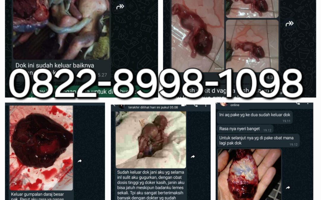 Fungsi Cytotec Obat Aborsi Penggugur Kandungan 1 sampai 8 bulan tanpa kuret Menurut Dokter Medis Farmasi 082289981098