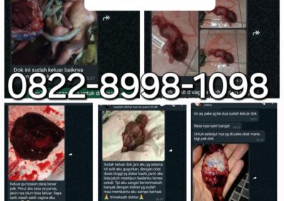 Fungsi Cytotec Obat Aborsi Penggugur Kandungan 1 sampai 8 bulan tanpa kuret Menurut Dokter Medis Farmasi 082289981098