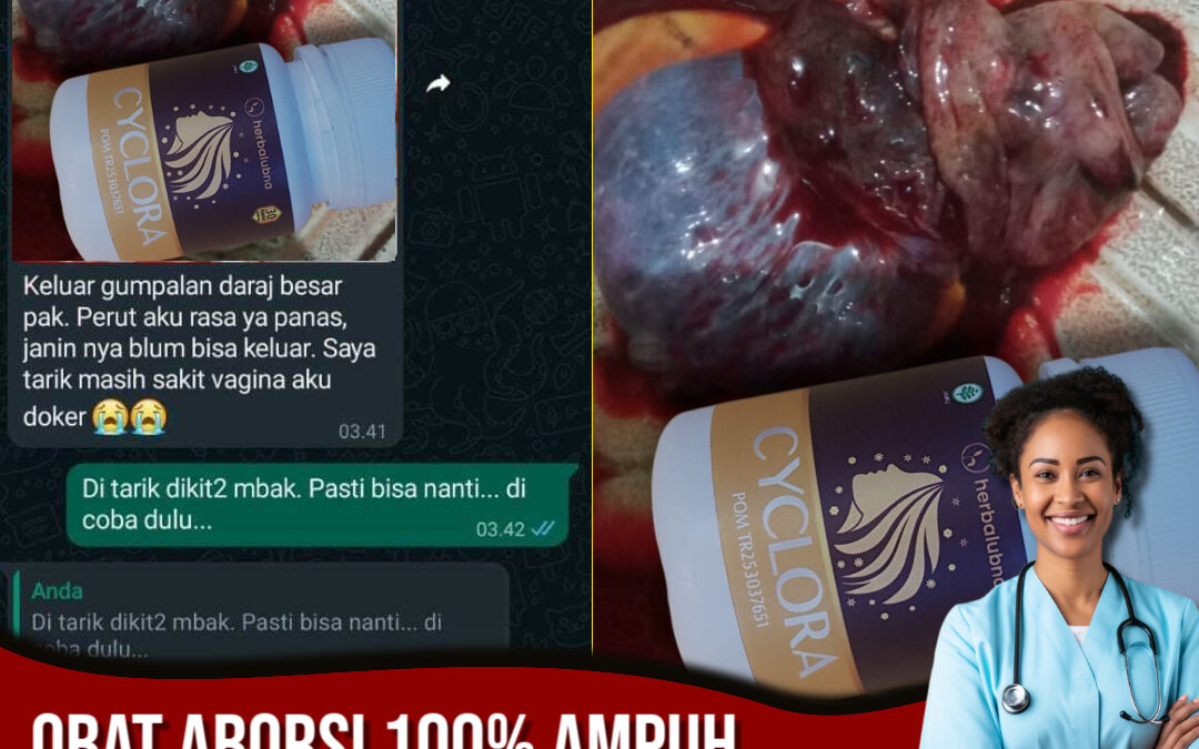 Tips Menggugurkan Kandungan 1 2 3 4 5 6 7 8 Bulan Tanpa Kuret Menurut Dokter dengan Cyclora