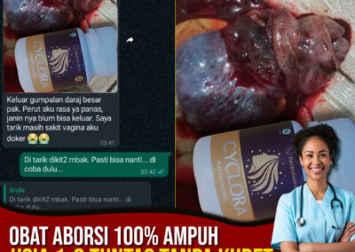 Tips Menggugurkan Kandungan 1 2 3 4 5 6 7 8 Bulan Tanpa Kuret Menurut Dokter dengan Cyclora