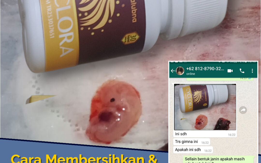 Agar haid lancer Cyclora: Atasi Penyebab Telat Haid dan Solusinya