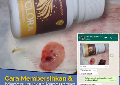 Cara mengatasi terlambat datang bulan Cyclora: Atasi Penyebab Telat Haid dan Solusinya