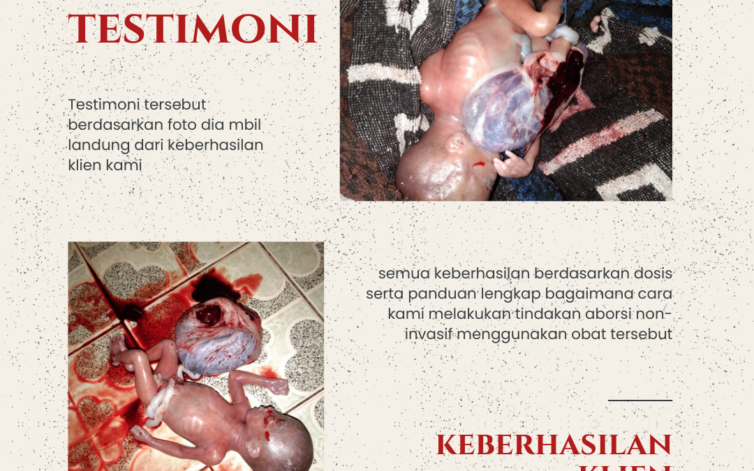 Harga Obat Cytotec Obat Aborsi Penggugur Kandungan 1 sampai 8 bulan tanpa kuret Menurut Medis | Dr. Lisa spOG 082289981098