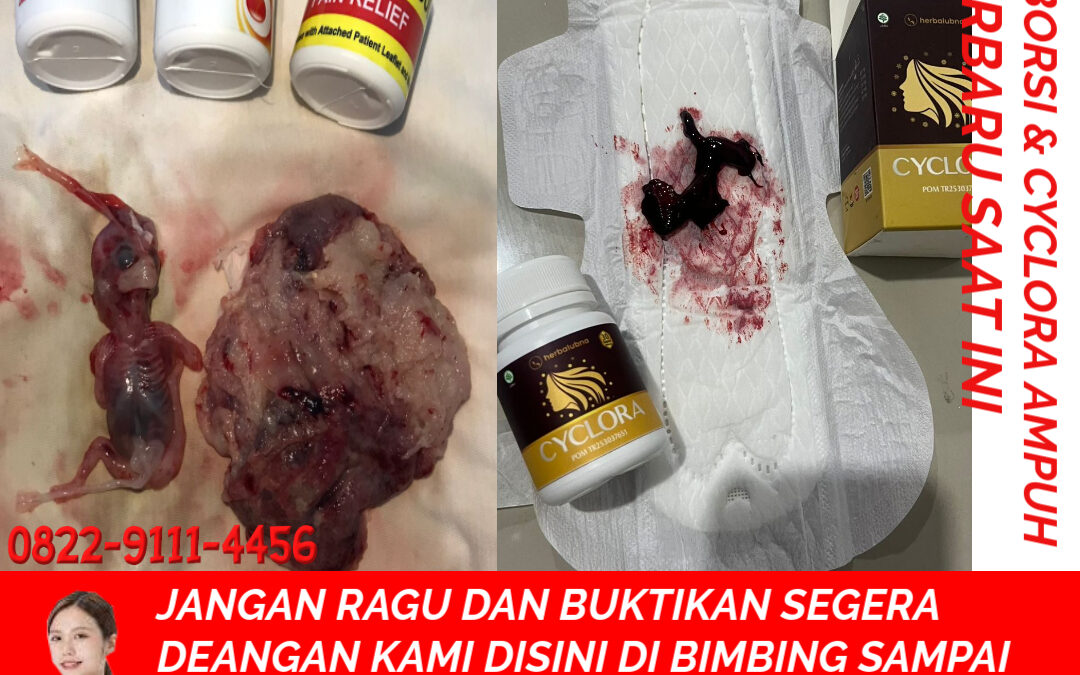 Apotik K24 Jual Obat Aborsi Asli 082291114456 Jual Cytotec Aceh Jaya