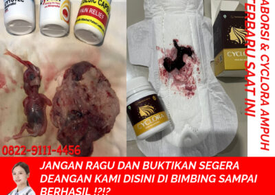Apotik K24 Jual Obat Aborsi Asli 082291114456 Jual Cytotec Aceh Jaya