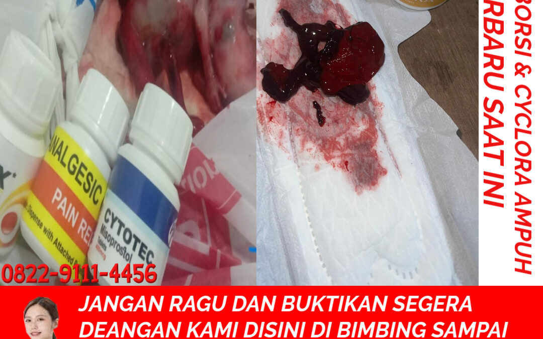 Cara Menggugurkan Kandungan dengan Cepat selesai dalam 24 jam secara Alami