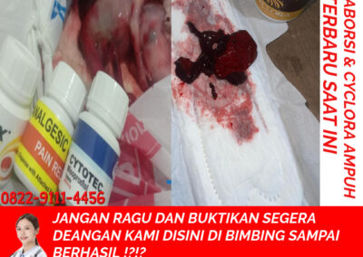 Cara Menggugurkan Kandungan dengan Cepat selesai dalam 24 jam secara Alami
