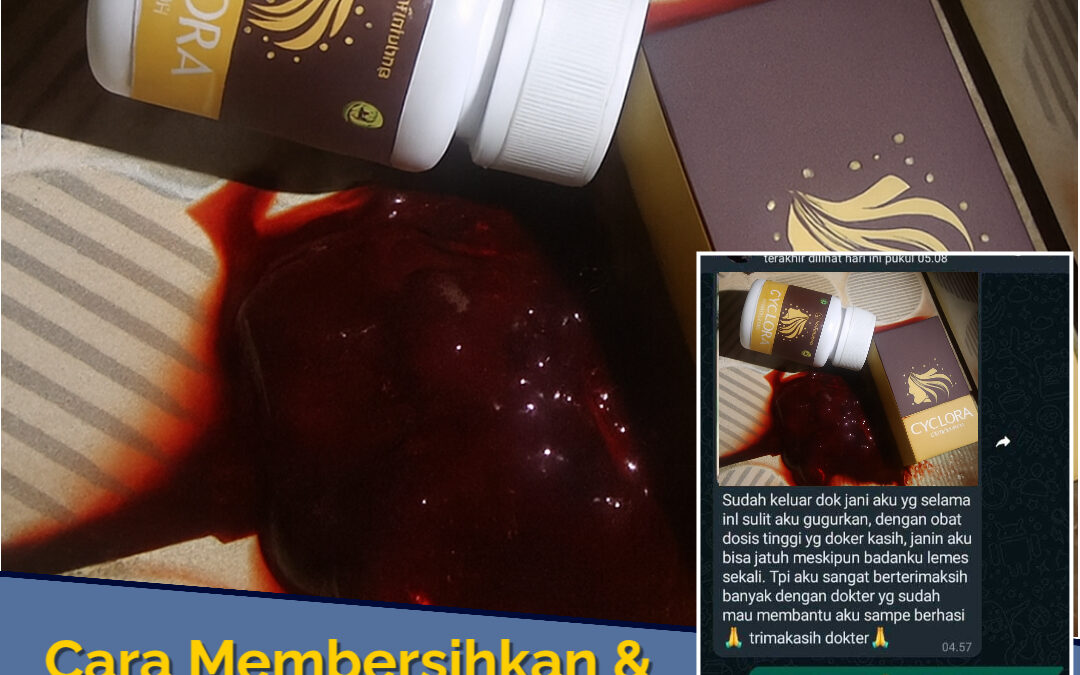 Cara mengatasi haid tidak teratur Cyclora: Atasi Penyebab Telat Haid dan Solusinya