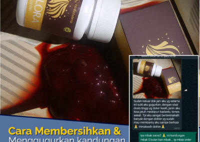 Cara mengatasi haid tidak teratur Cyclora: Atasi Penyebab Telat Haid dan Solusinya